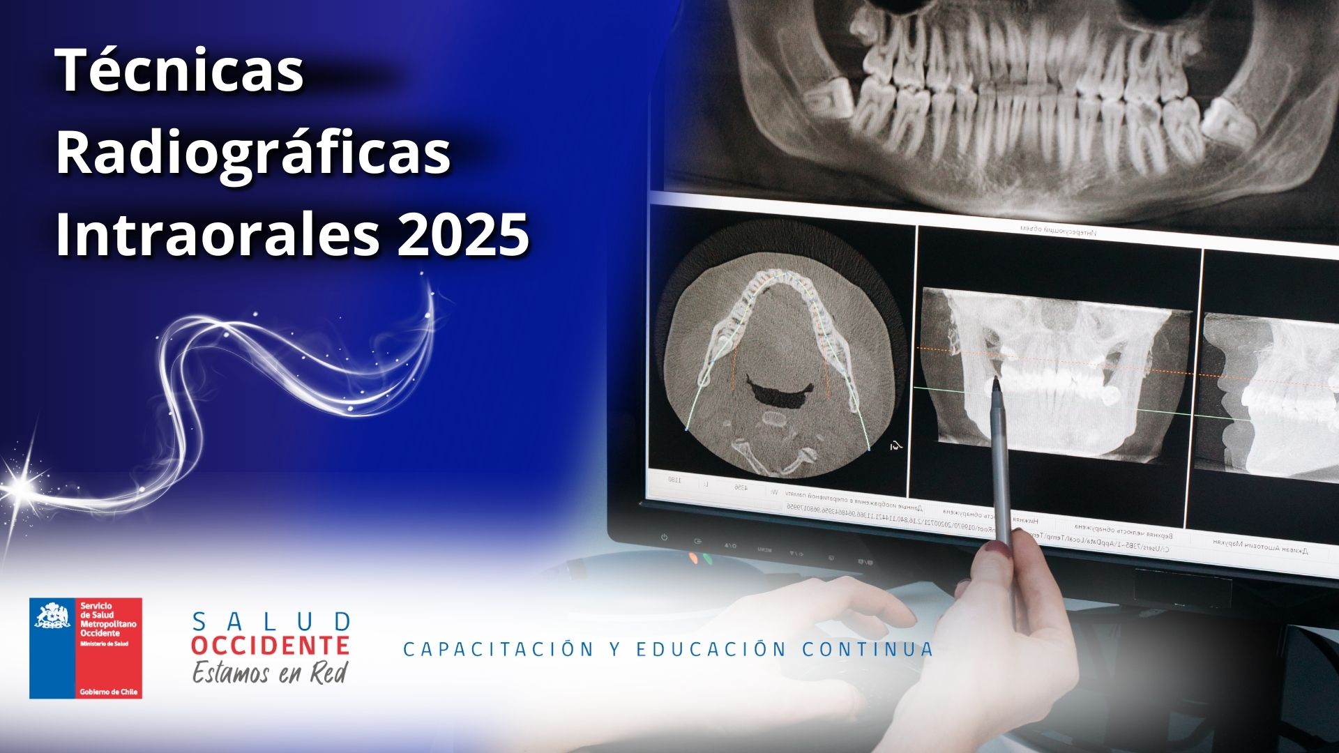 Técnicas Radiográficas Intraorales 2025