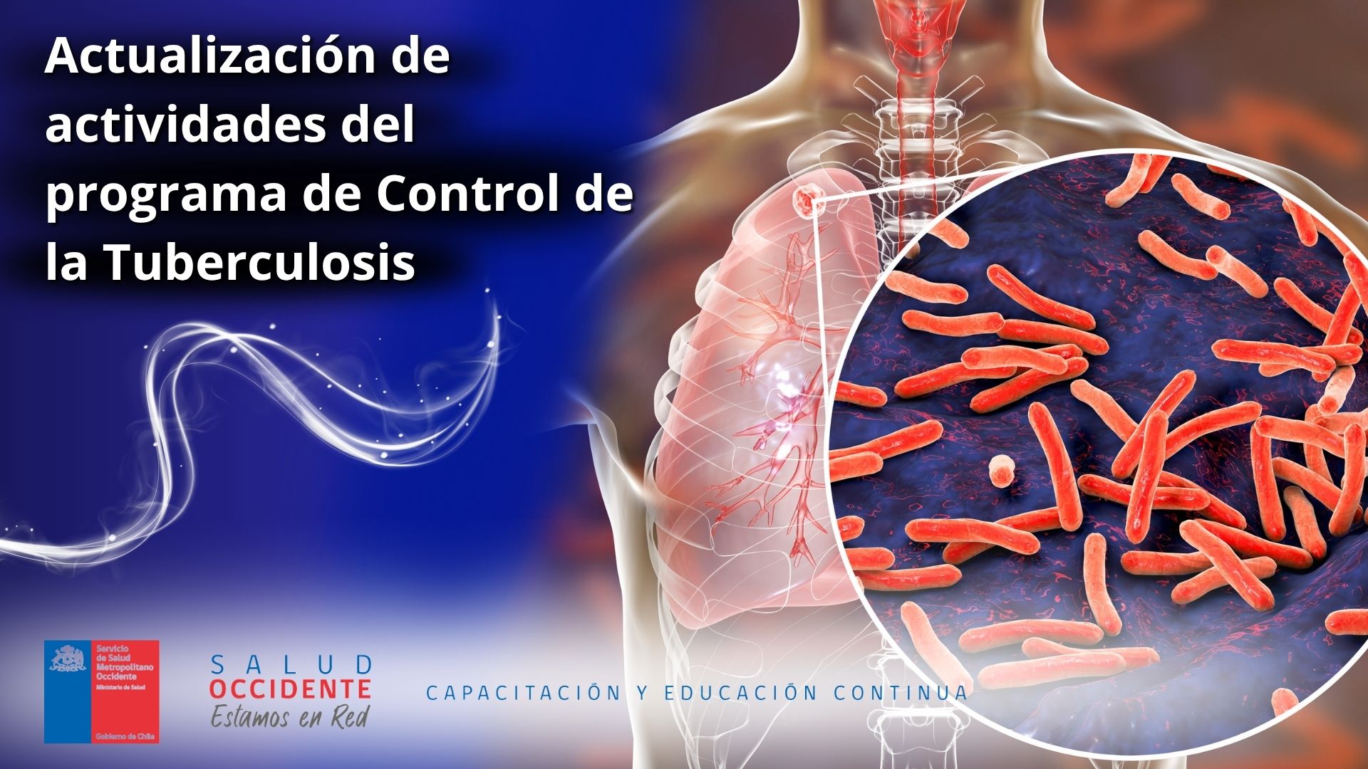 Actualización de actividades del Programa de Control de la Tuberculosis