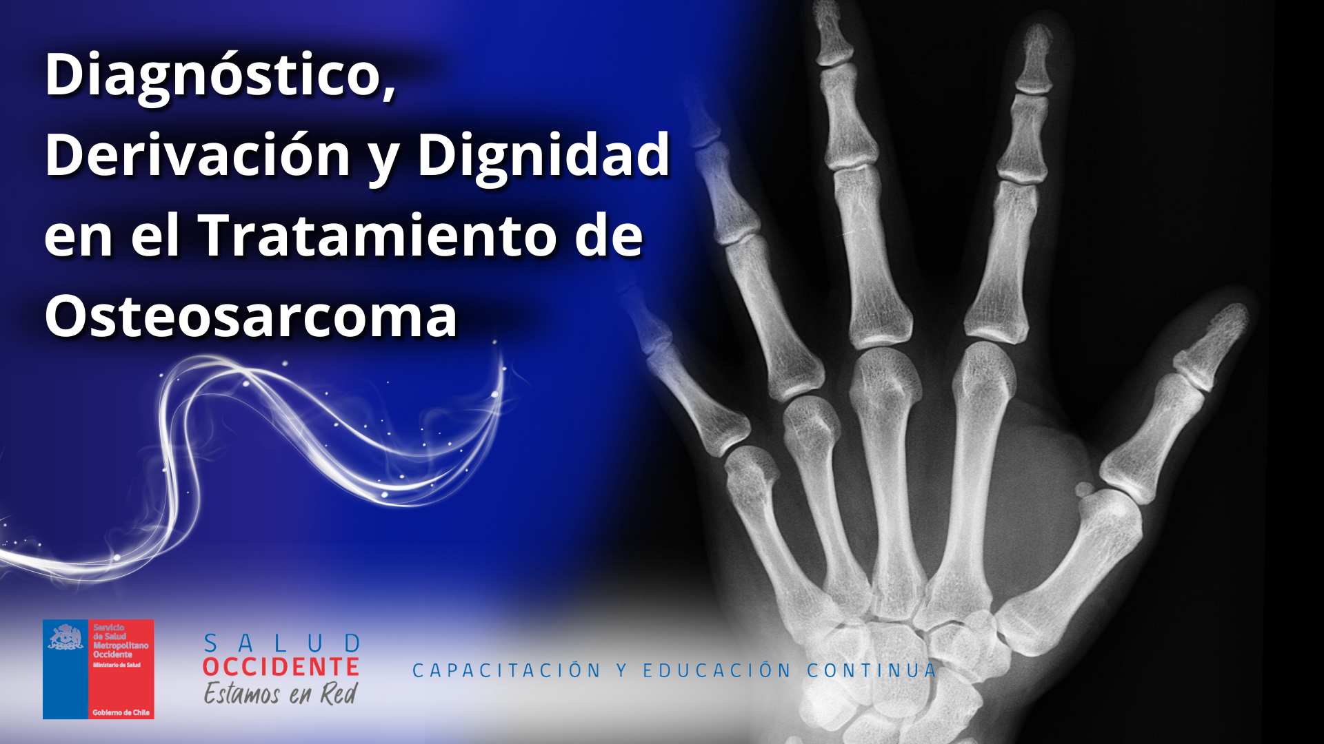 Diagnóstico, Derivación y Dignidad en el Tratamiento de Osteosarcoma